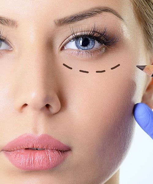 Avaliação Periocular